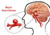 Anevrizma